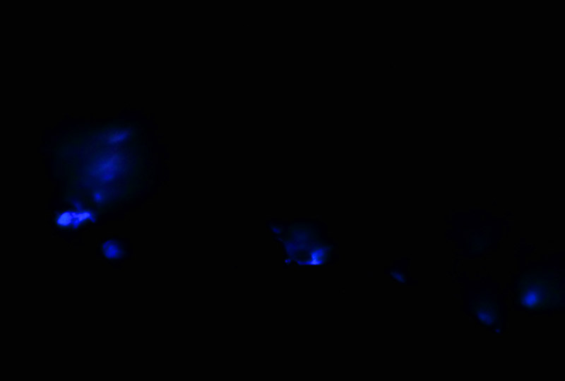 Kawah Ijen blue lights